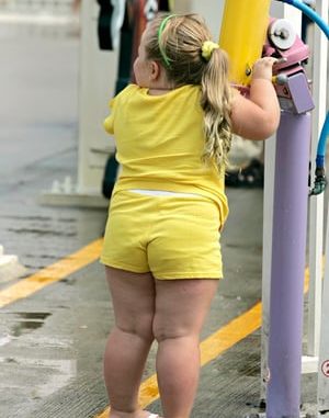 An-overweight-child.-005
